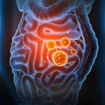 Holistic Approach to Gut Health