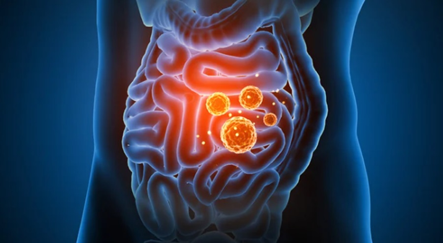 Holistic Approach to Gut Health