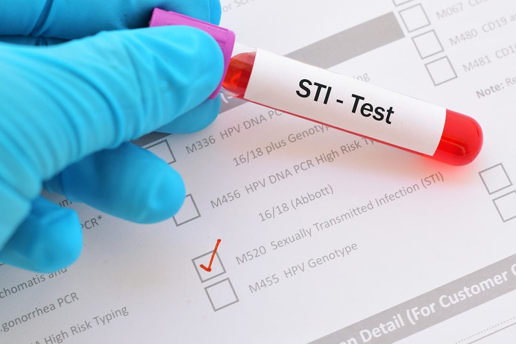STD Test Insights That Promote Responsible Health Choices