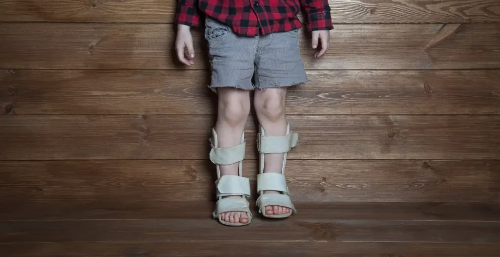 Comparing AFO and SMO Braces and Their Role in Modern Orthotic Care